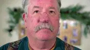Every Rosacea Has Its Thorn still