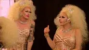 Conjoined Twins still