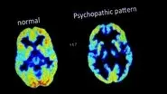 What Makes a Psychopath? still